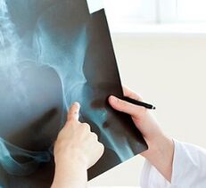 How to treat arthrosis of hip joint