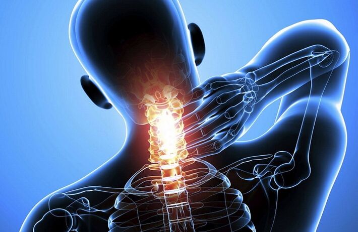 Cervical osteocondrosis