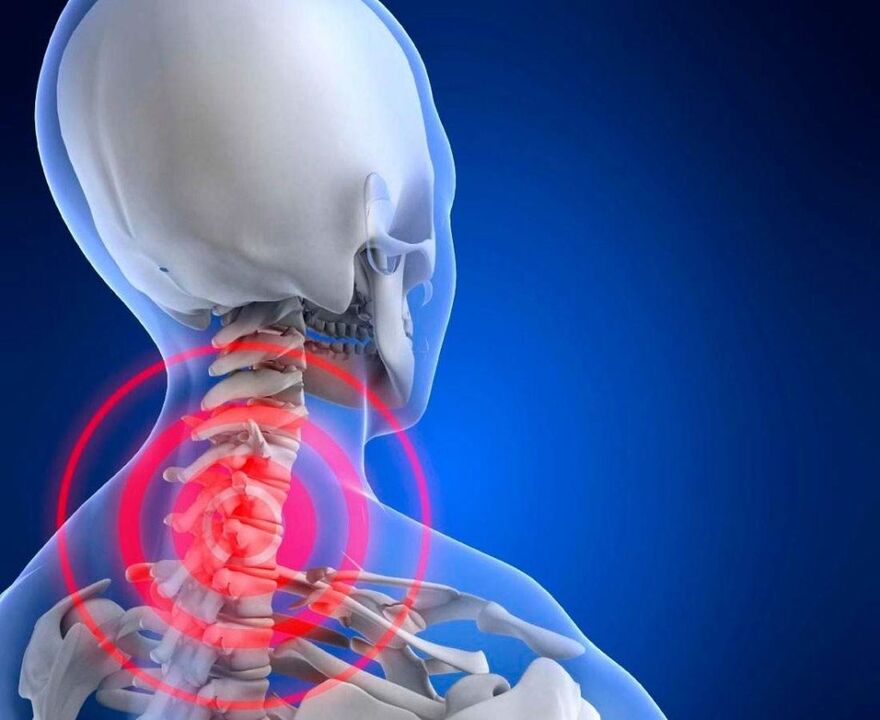 neck pain with cervical osteocondrosis