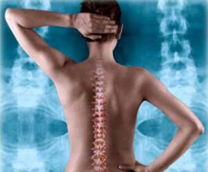 Back bellidustration