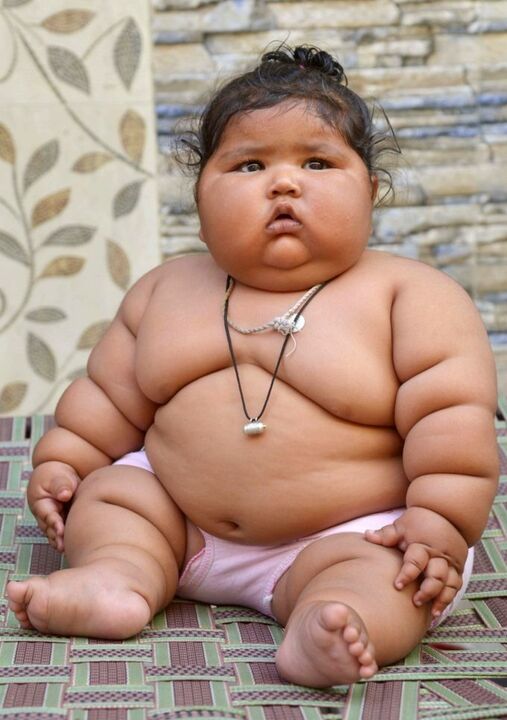Excess weight causes arthrosis