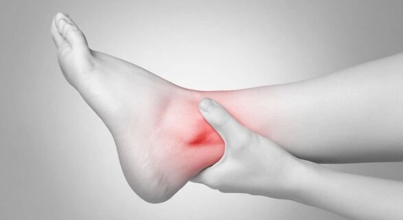 Joint stiffness and chronic ankle pain are complications of chrysarthrosis