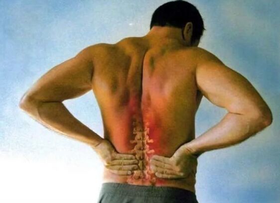 Pain for lomber osteocondrosis